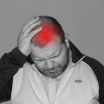Using CBD for migraines and headaches
