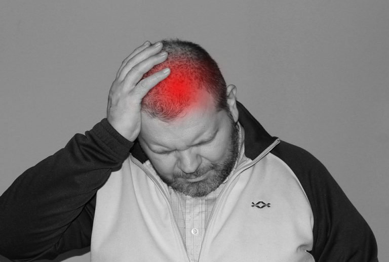 Using CBD for migraines and headaches